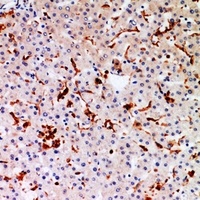 CYBB antibody