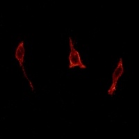 Anti-GPR40 Antibody