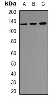 Focal Adhesion Kinase Rabbit Polyclonal Antibody