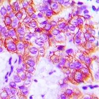 Anti-Focal Adhesion Kinase Antibody