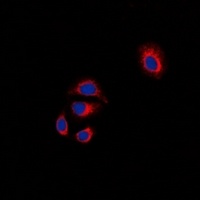 Anti-Focal Adhesion Kinase Antibody