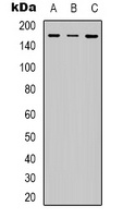 IRS1 (Phospho-S312) Rabbit Polyclonal Antibody