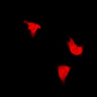 IRS1 (Phospho-S312) Rabbit Polyclonal Antibody