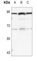 B-RAF (Phospho-S446) Antibody