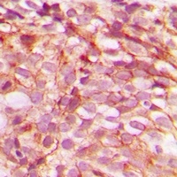 B-RAF (Phospho-S446) Antibody
