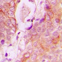 Anti-RAB34 Antibody