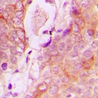 RAB34 antibody