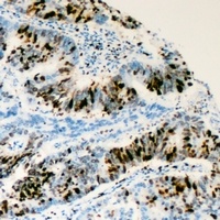 Anti-RRS1 Antibody