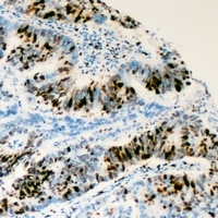 RRS1 antibody