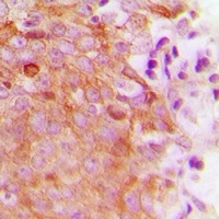 Anti-MRRF Antibody