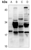 GAS3 Antibody