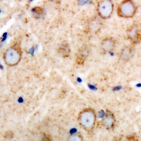 GAS3 Antibody