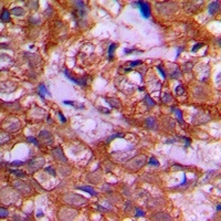 Anti-DZIP3 Antibody
