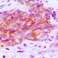 EGFR (phospho-Y1016) antibody