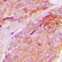 Anti-WASF1 (Phospho-Y125) Antibody