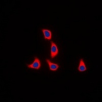 Anti-WASF1 (Phospho-Y125) Antibody