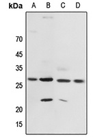 14-3-3 zeta (Phospho-T232) Antibody