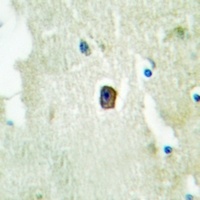 Anti-HER3 (Phospho-Y1289) Antibody