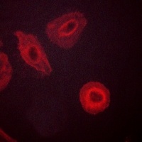 Anti-HER3 (Phospho-Y1289) Antibody
