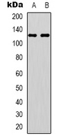 EPHA4 (Phospho-Y596) Antibody