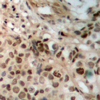 Anti-JAK2 Antibody
