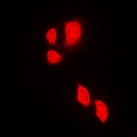 Anti-JAK2 Antibody