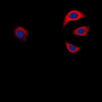 GAB1 antibody