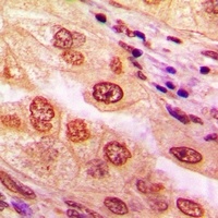 CaMK4 Antibody