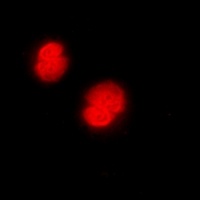 CaMK4 Antibody