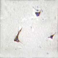 SDC4 antibody