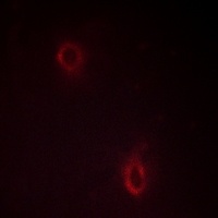 SDC4 antibody