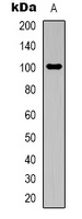 Aconitase 1 Rabbit Polyclonal Antibody