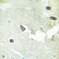 Anti-GKAP Antibody