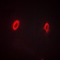 Anti-GKAP Antibody