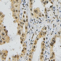Anti-TBX1 Antibody