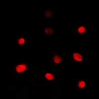 Anti-TBX1 Antibody