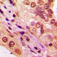 Anti-TBX10 Antibody
