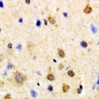 Anti-PSKH1 Antibody