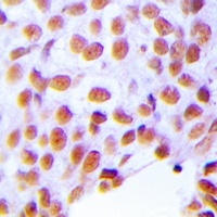 Anti-ZNF24 Antibody