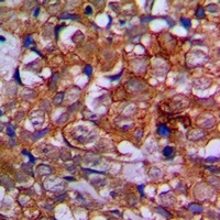 Anti-EPHA1 Antibody