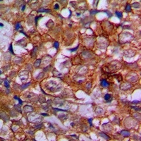 EPHA1 antibody