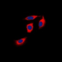 Anti-EPHA1 Antibody