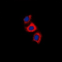 RCVRN antibody