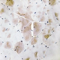 Anti-MKK4 Antibody