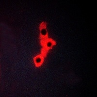 Anti-MKK4 Antibody