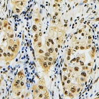 Anti-ID4 Antibody