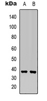 MKK6 Rabbit Polyclonal Antibody