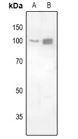 FOXK1 Antibody