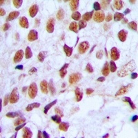 Anti-FOXK1 Antibody