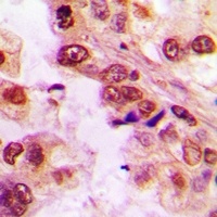 Anti-ASC-1 Antibody